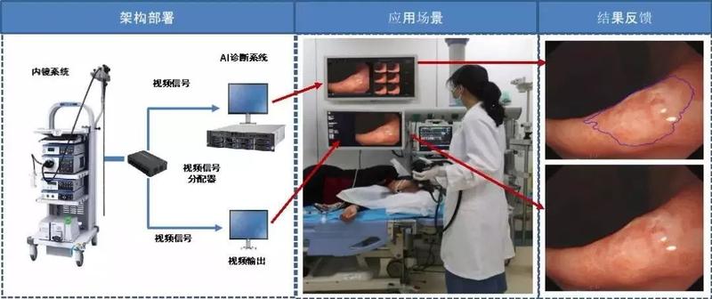 胃镜最新检查方法,创新技术引领，胃镜检查再升级