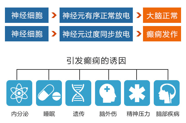 癫痫病最新疗法,癫痫治疗领域新突破，前沿技术引领疗法革新。