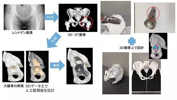 打印髋关节最新进展(探索髋关节研究新动态)